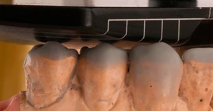 Éxito clínico basado en planeación bio-funcional