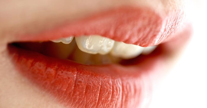 Individualized esthetics with IPS e.max