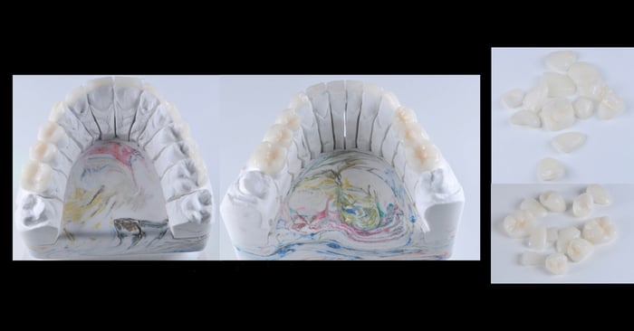 Procedimentos clínicos em reabilitação oral para atingir excelência clínica