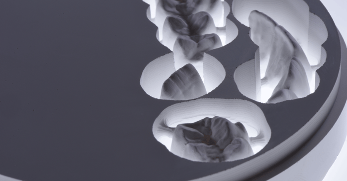 Fascinating Zirconia - processing techniques & esthetics