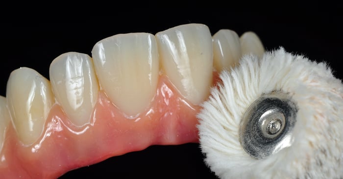 Les composites antérieurs, la fiabilité en toute simplicité