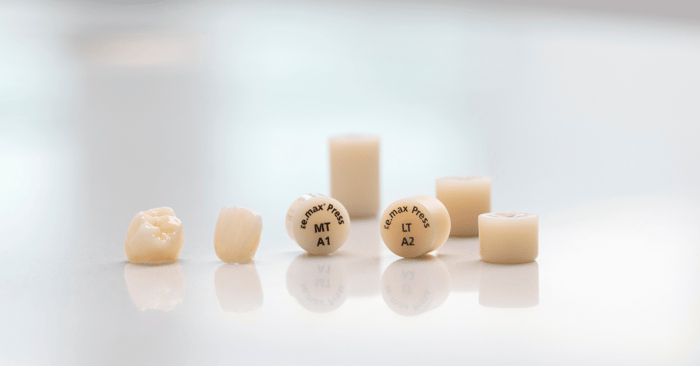 A story of a tooth: From a restoration to an implant. Which one is complication-free?