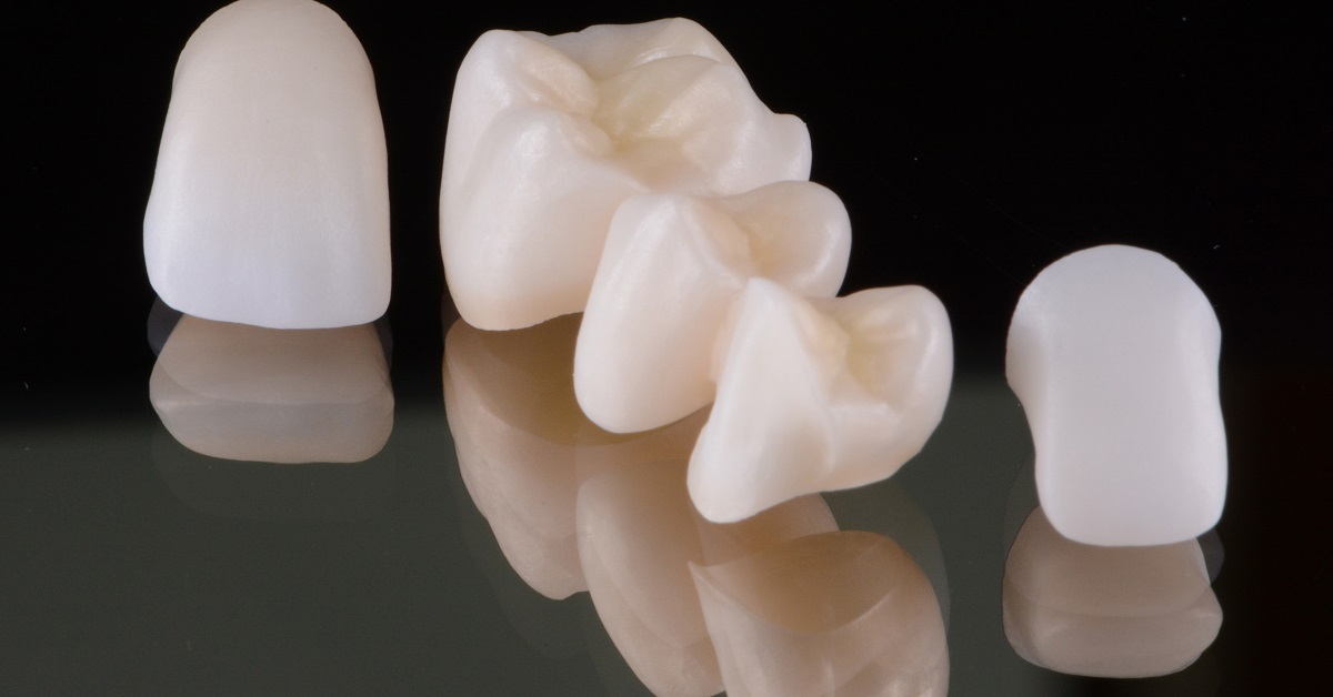 Challenges in prosthetic adhesive dentistry