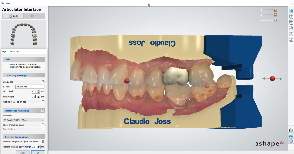 How to proceed - From intraoral scanning to the printed model