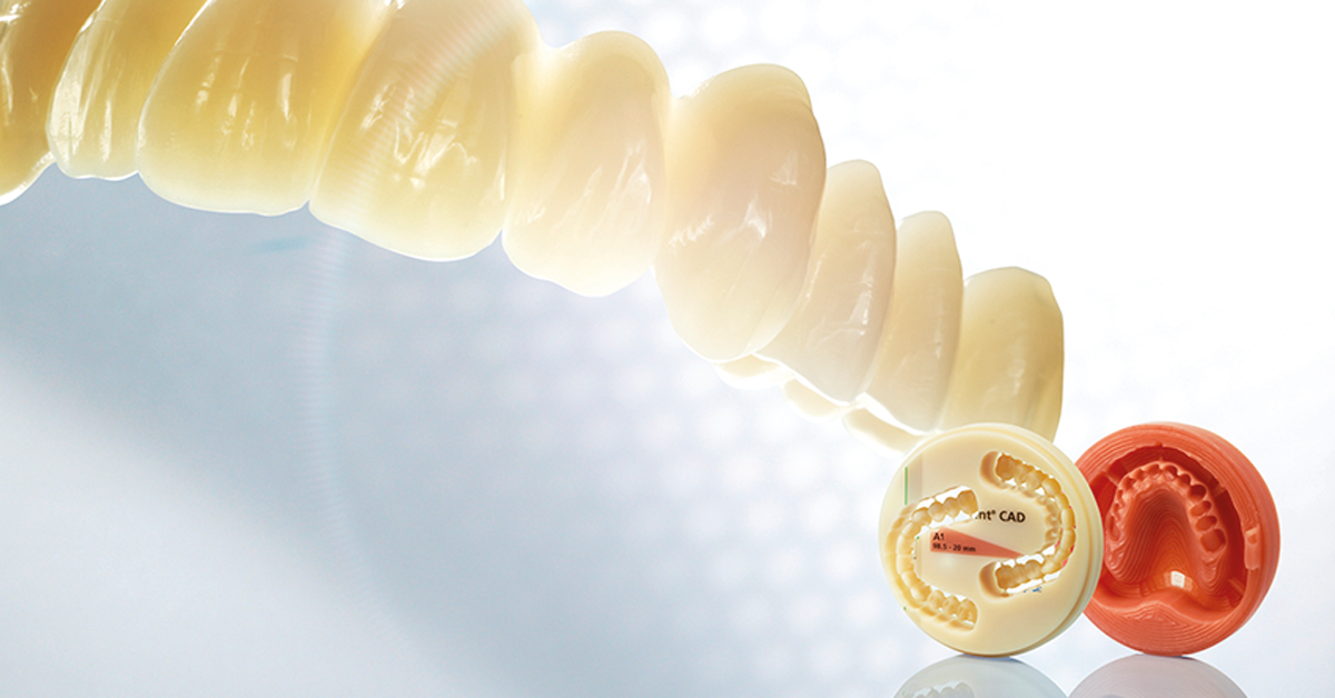 Digital Fabricated Dentures: A New Paradigm in Removable