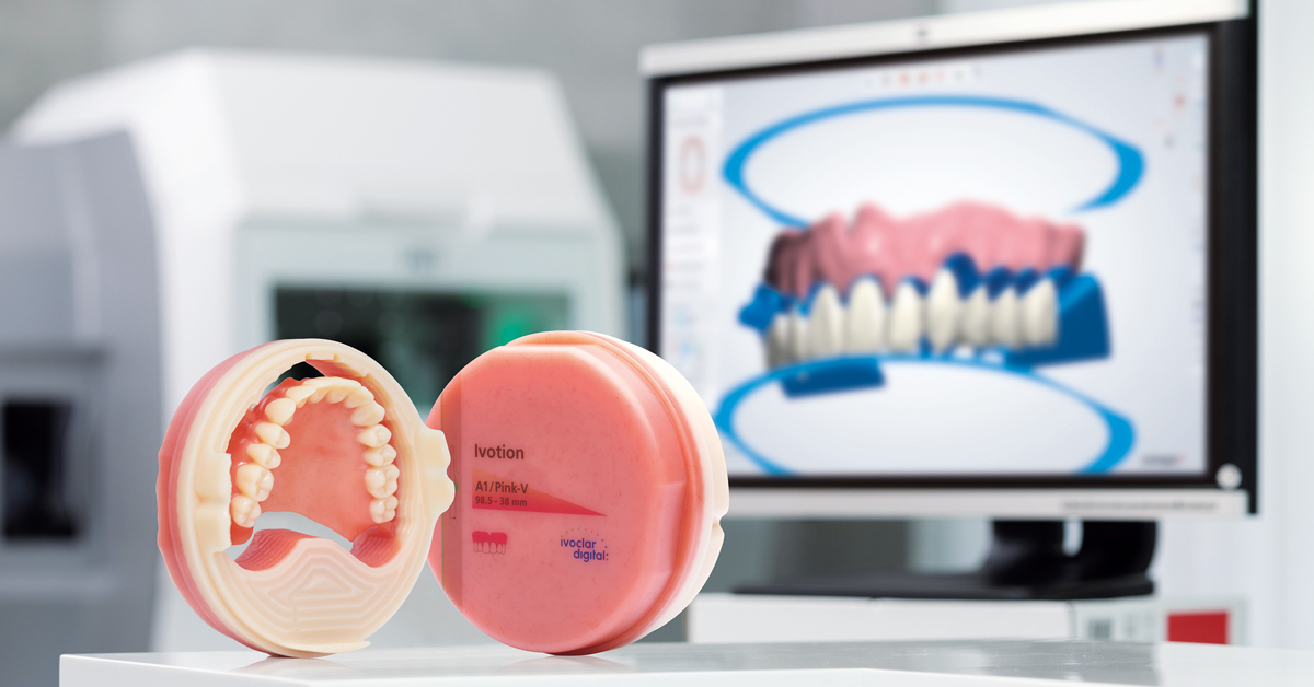 Introduction to Digital Dentures featuring Ivotion