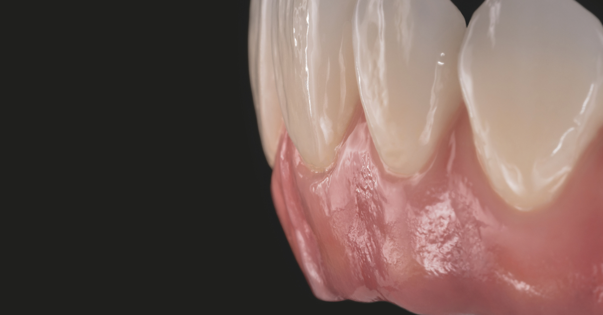 Innovation : la nouvelle génération de céramique pour caractérisation et micro-stratification