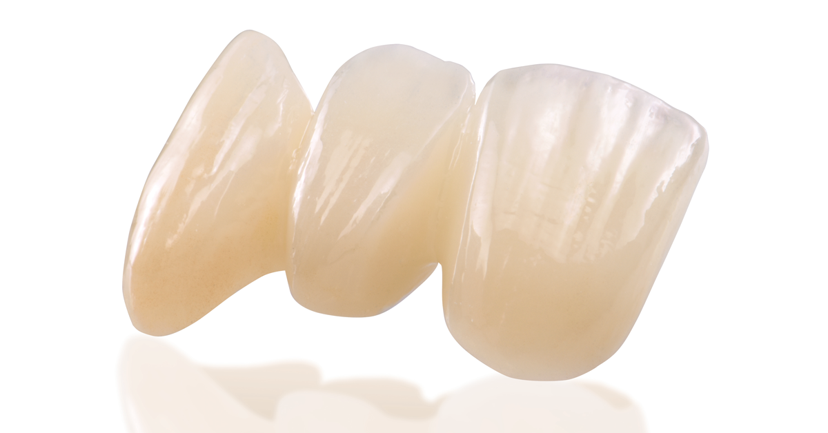 Aesthetic Zirconia in my Clinical Theater